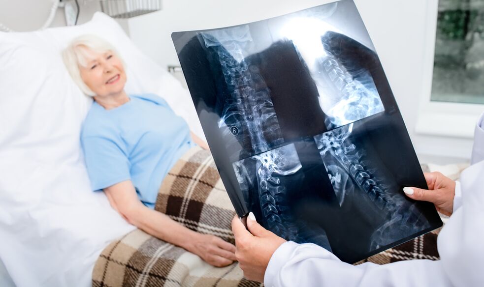 Osteochondrozės diagnozė