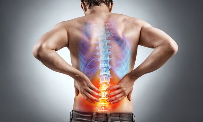 apatinės nugaros dalies skausmo priežastys
