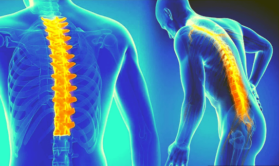 Stuburo osteochondrozė