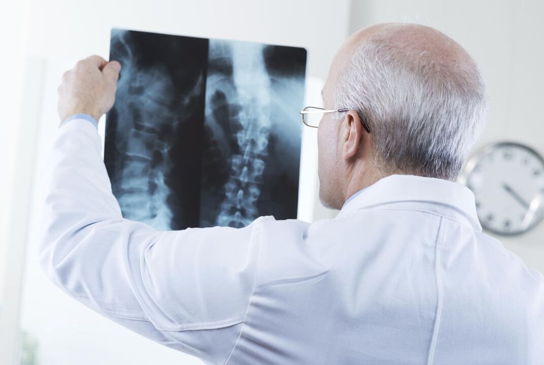 gydytojas tiria kaklo stuburo su osteochondroze momentinę nuotrauką